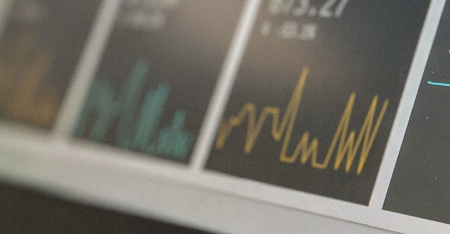 CVM inicia audiência pública sobre o novo marco regulatório dos agentes autônomos de investimento